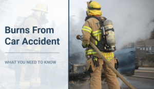 Burns From Car Accident: What You Need To Know
